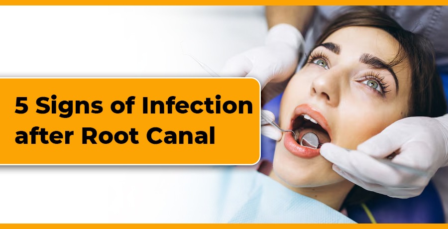 Signs of Infection After Root Canal