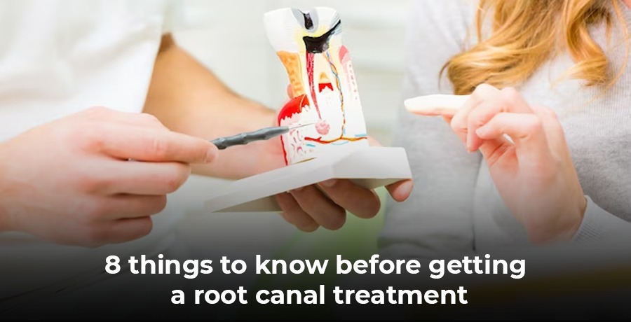 8 Things To Know Before Getting A Root Canal Treatment