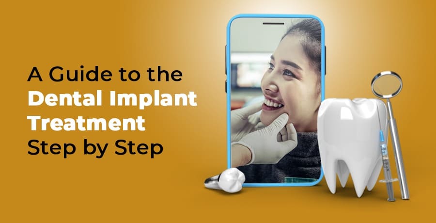 A Guide To The Dental Implant Treatment Step By Step