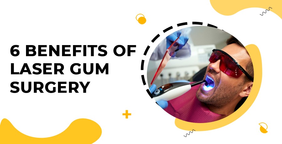 Benefits Of Laser Gum Surgery