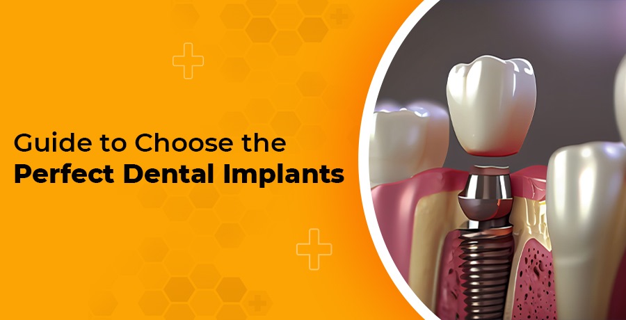 Perfect Dental Implants