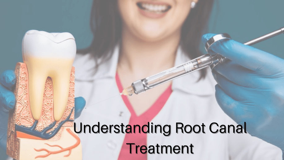 Understanding-Root-Canal-Treatment