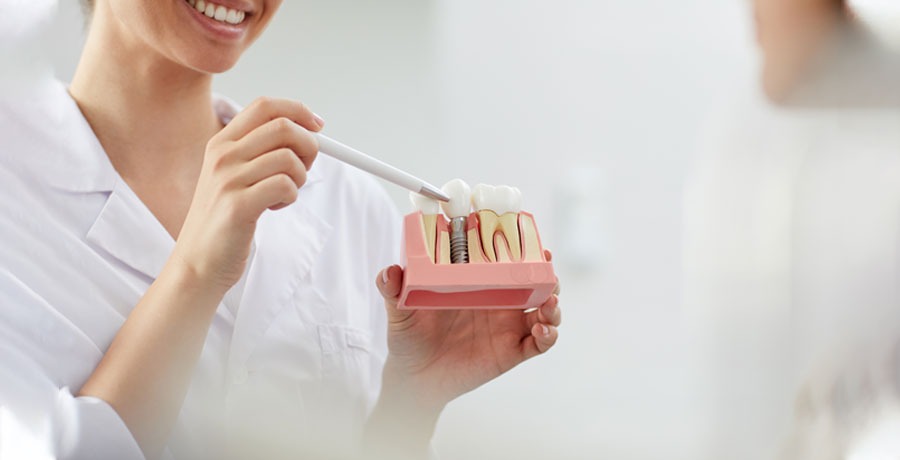 difference between before and post dental implants