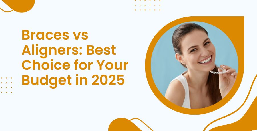 Braces vs Aligners