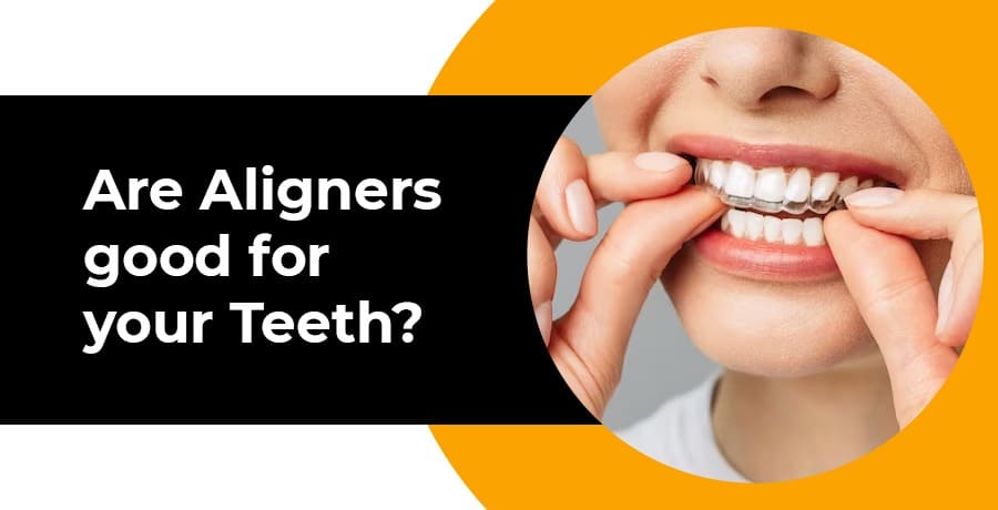 are aligners good for your teeth