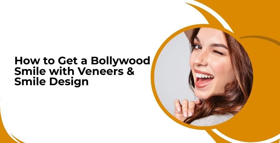 Bollywood Smile with Veneers