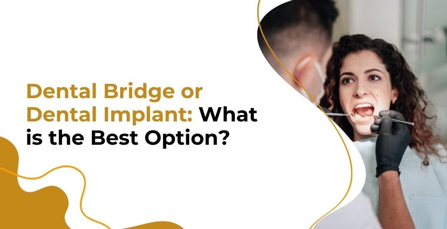 Dental Bridge Or Dental Implant