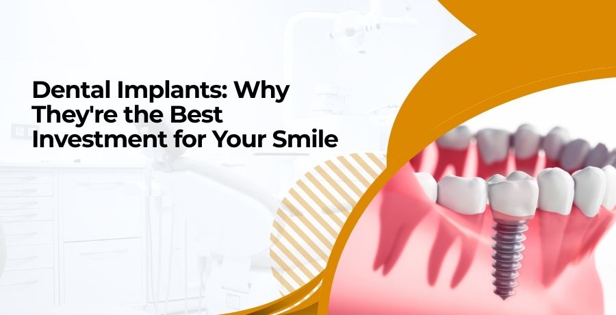 Dental Implants the best investment for smile