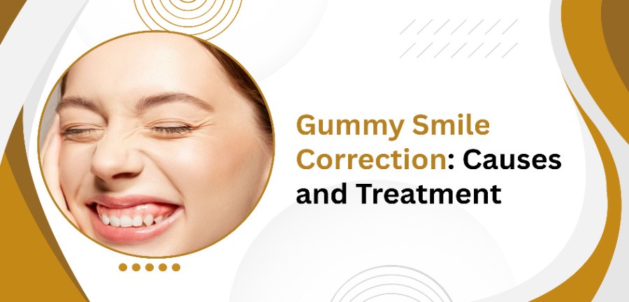 Gummy Smile Correction