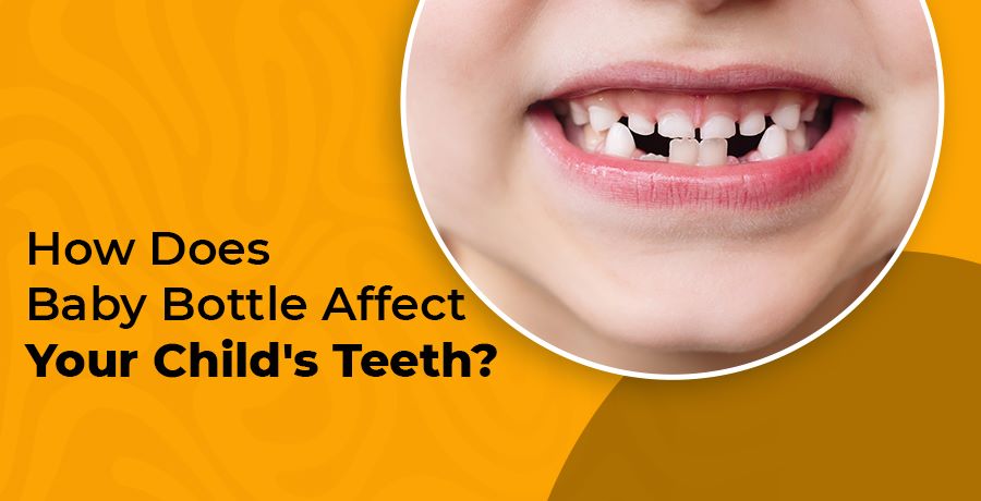 Baby Bottle tooth Decay