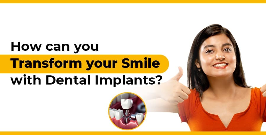 how can you transform your smile with dental implants