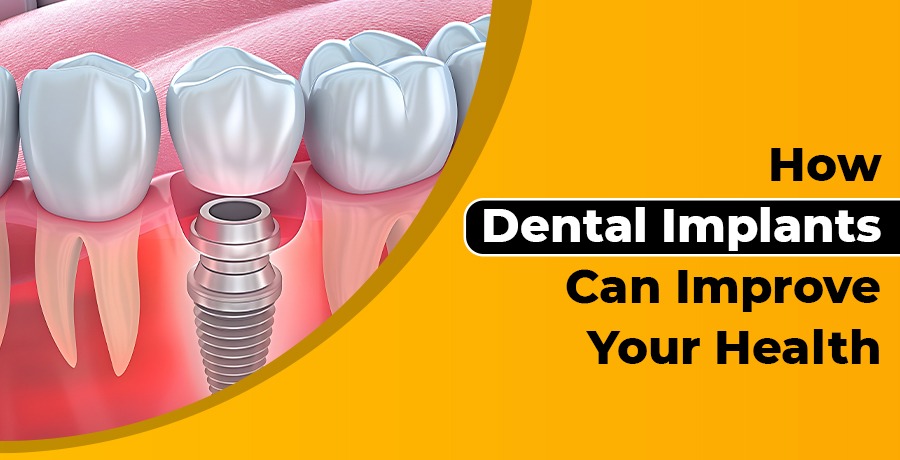 Signs of Infection After Root Canal