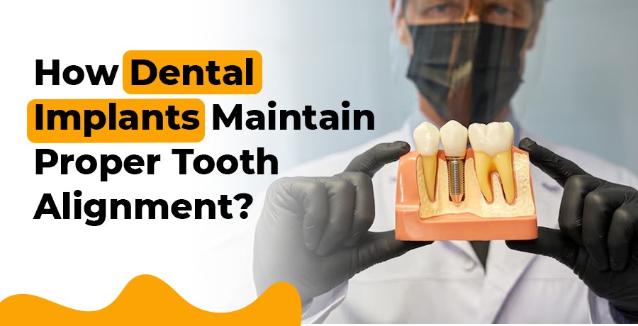 Dental Implant for Tooth Alignment