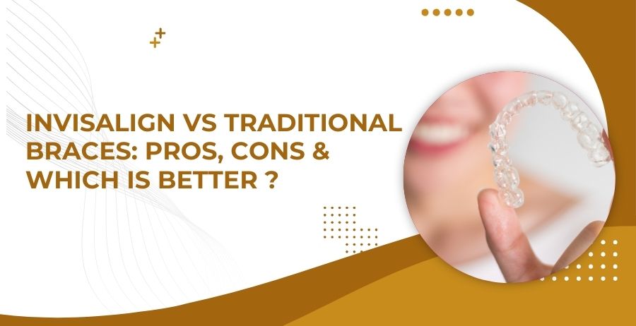 Invisalign vs Braces: Which is Better