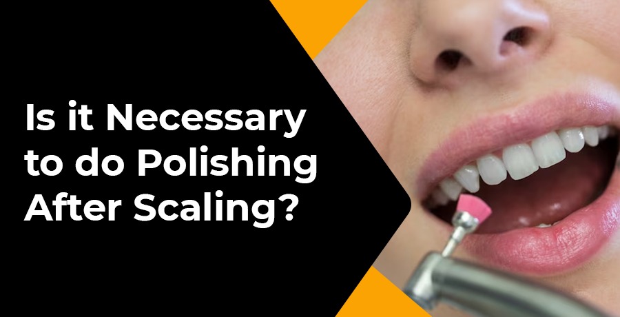 is it necessary to do polishing after scaling