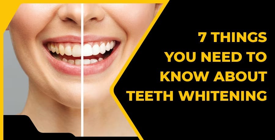 know all about teeth whitening