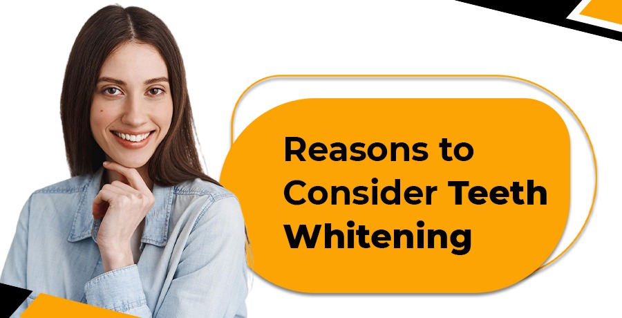 Reasons to Consider Teeth Whitening