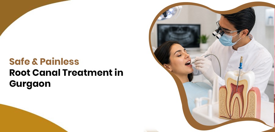 Safe and Painless Root Canal Treatment in Gurgaon