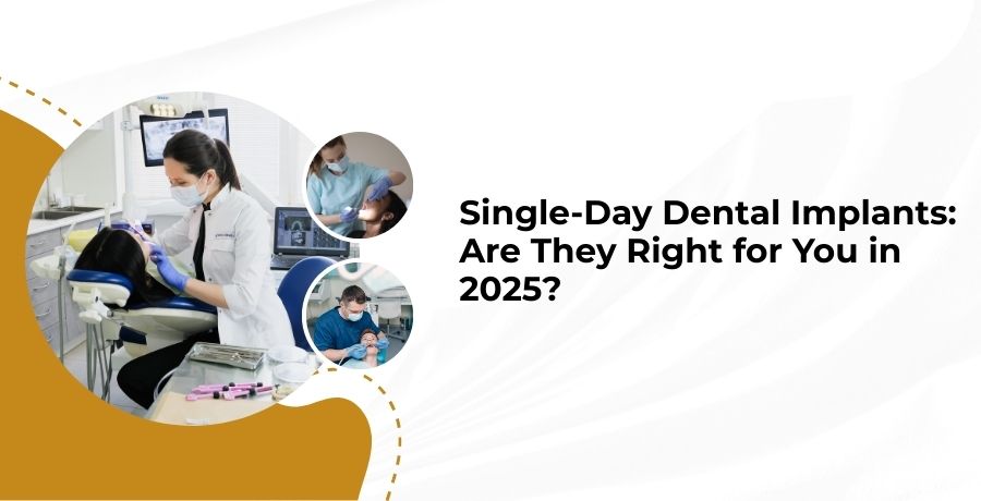 Single Day Dental Implants
