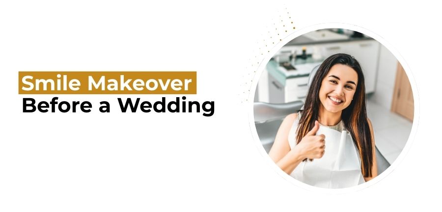 Smile Makeover Before Wedding
