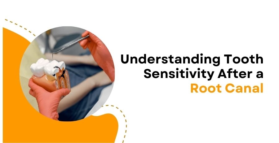 Tooth Sensitivity After Root Canal