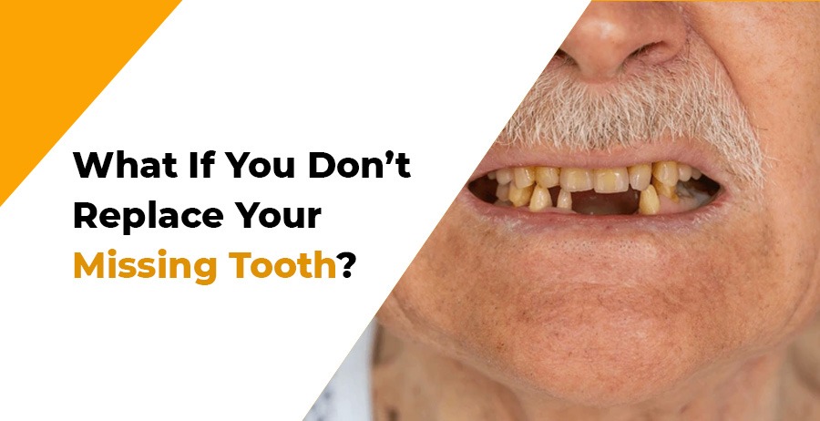 Replace your missing tooth