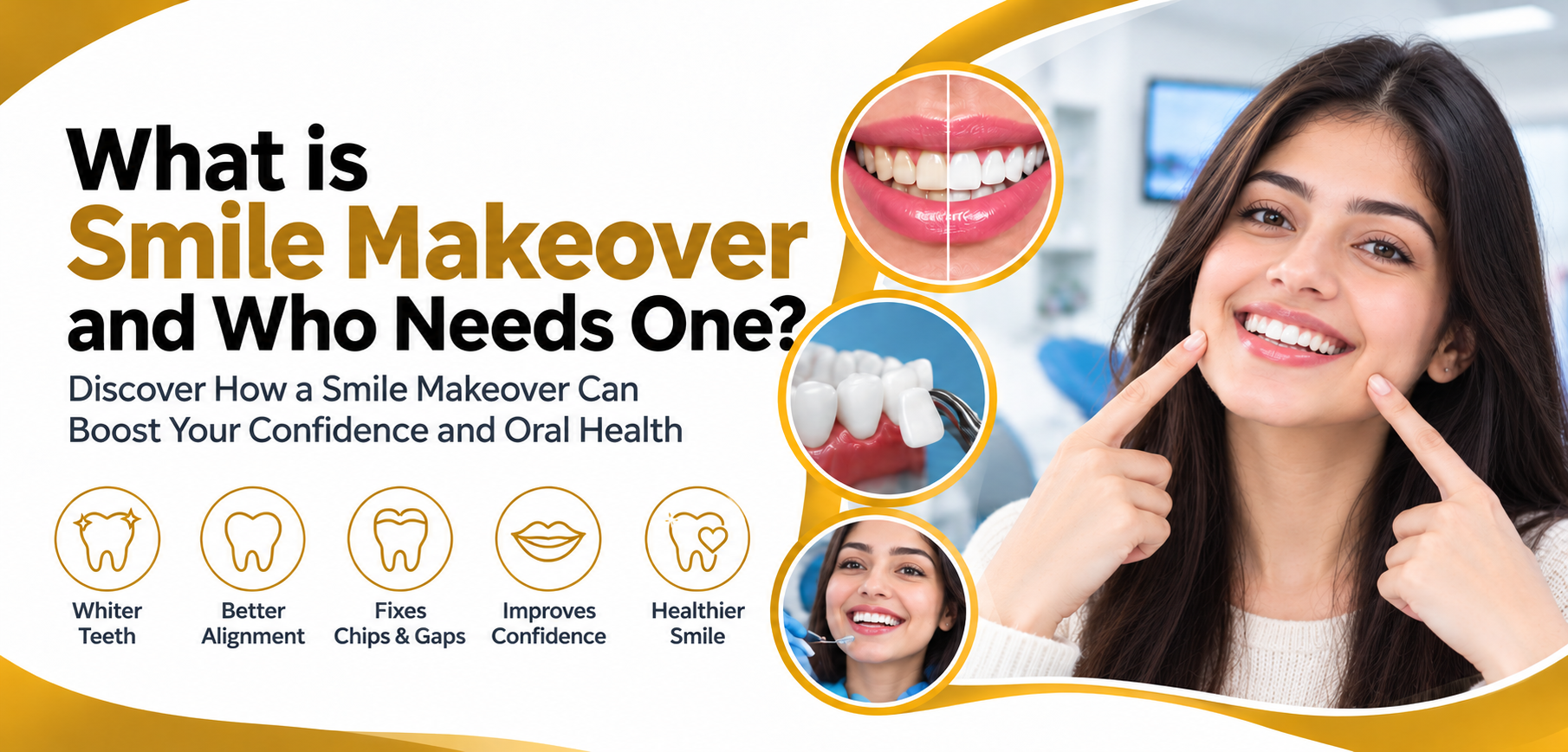 what is smile makeover